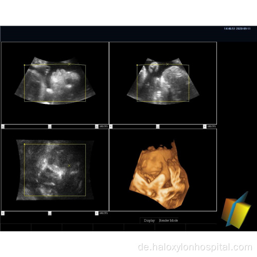 Medizinische Geräte 19 &quot;LCD-Monitor-Ultraschallscanner